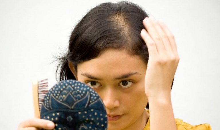 6 Bahan Alami untuk Mengatasi Rambut Rontok Akibat Smoothing