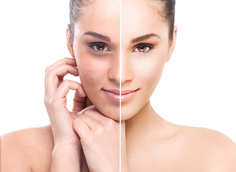 15 Manfaat Skin Care untuk Kecantikan - parasayu.net